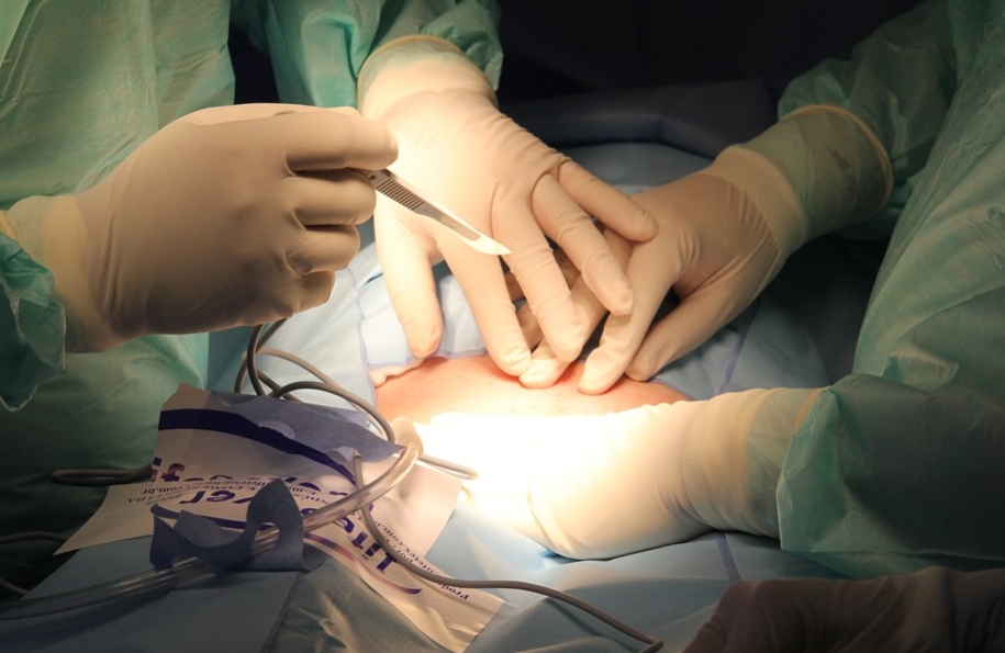 surgery operation