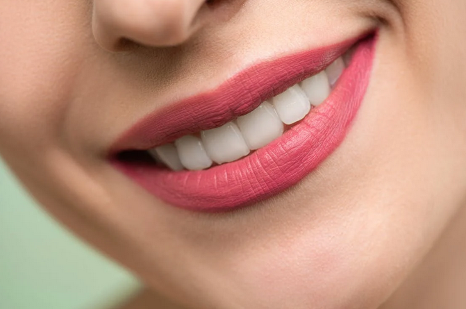 teeth whitening