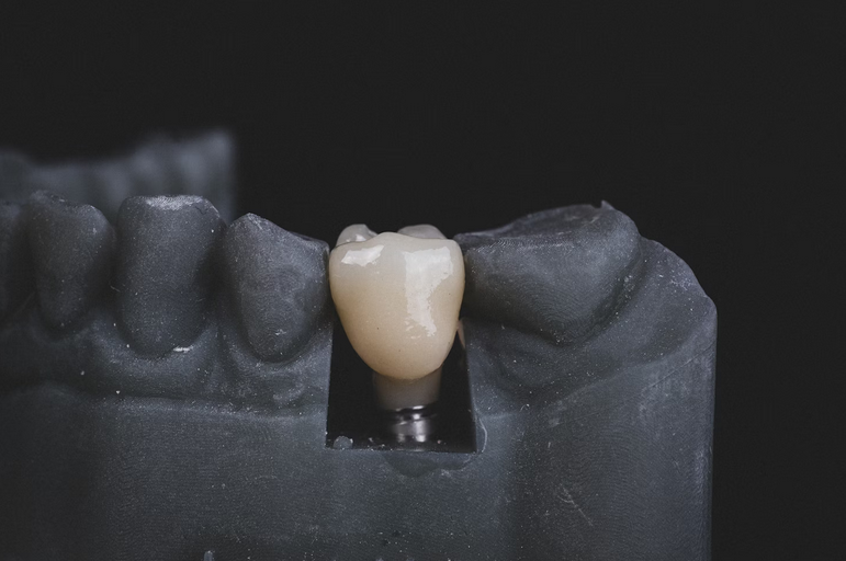 implant